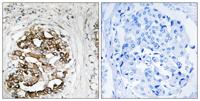 Myt 1 Polyclonal Antibody