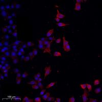 N/H/K-Ras Polyclonal Antibody