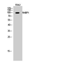 N4BP1 Polyclonal Antibody