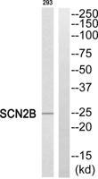 Na+ CP type IIβ Polyclonal Antibody