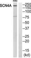 Na+ CP type IVα Polyclonal Antibody