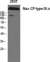 Na+ CP type IXα Polyclonal Antibody