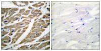 Na+ CP-pan Polyclonal Antibody