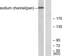 Na+ CP-pan Polyclonal Antibody