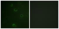 Na+/K+-ATPase α1 Polyclonal Antibody