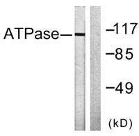 Na+/K+-ATPase α1 Polyclonal Antibody