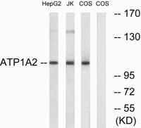 Na+/K+-ATPase α2 Polyclonal Antibody