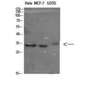 Nanos Homologue 1 (NANOS1) Polyclonal Antibody