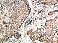 Napsin A Polyclonal Antibody