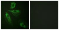 ADD1 Polyclonal Antibody