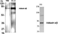 Adducin α/β Polyclonal Antibody