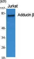 Adducin β Polyclonal Antibody