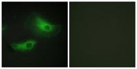 Adducin β Polyclonal Antibody