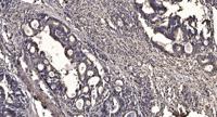 NBEAL1 Polyclonal Antibody