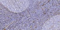 NBPF5 Polyclonal Antibody