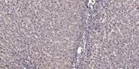 NBPF7 Polyclonal Antibody