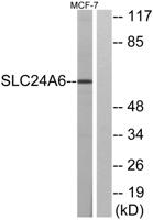 NCKX6 Polyclonal Antibody