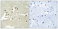 NCoA-5 Polyclonal Antibody