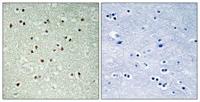 NCoA-7 Polyclonal Antibody