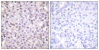 N-CoR Polyclonal Antibody