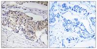 NDUFA3 Polyclonal Antibody