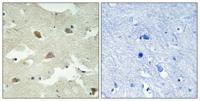 NEEP21 Polyclonal Antibody