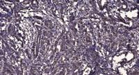 NEIL3 Polyclonal Antibody