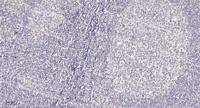 Nephrocystin-5 Polyclonal Antibody