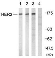 HER2 Polyclonal Antibody