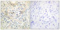 NGEP Polyclonal Antibody
