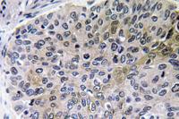 NGF Polyclonal Antibody