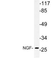 NGF Polyclonal Antibody