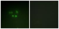 Nibrin Polyclonal Antibody