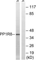 NIPP1 Polyclonal Antibody