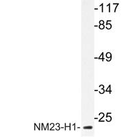 NM23-H1 Polyclonal Antibody