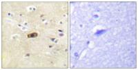 NMDAε1/2 Polyclonal Antibody