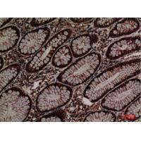 ERp57 Polyclonal Antibody