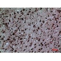 ERp57 Polyclonal Antibody
