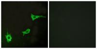 ETAR Polyclonal Antibody