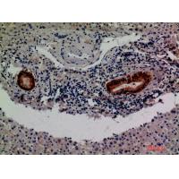 Factor XIII B Polyclonal Antibody
