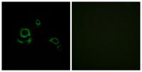 Factor XIII B Polyclonal Antibody