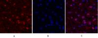 FAK Polyclonal Antibody