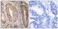 FAK Polyclonal Antibody