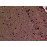 Fascin 1 Polyclonal Antibody
