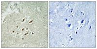 FBP3 Polyclonal Antibody