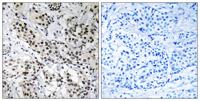 Fe65L Polyclonal Antibody