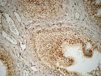 FEN-1 Polyclonal Antibody