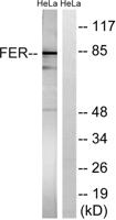 Fer Polyclonal Antibody