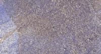 Fer Polyclonal Antibody