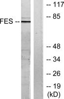 Fes Polyclonal Antibody